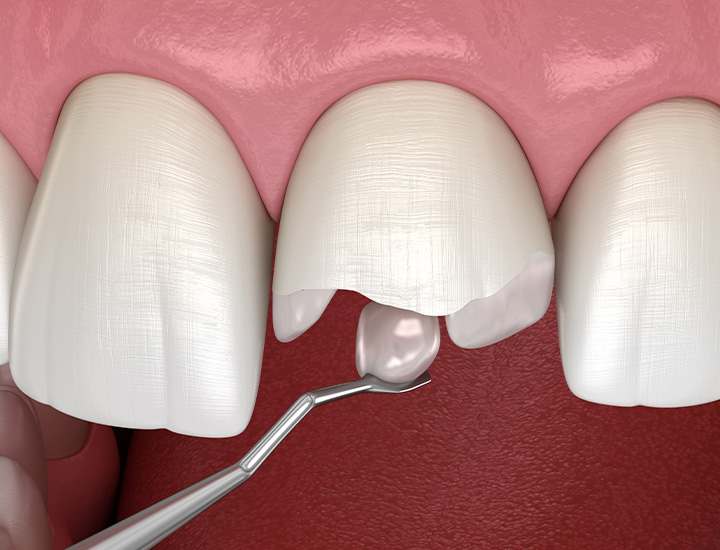 Restorative Dentistry